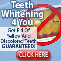 Teeth Whitening 4 You